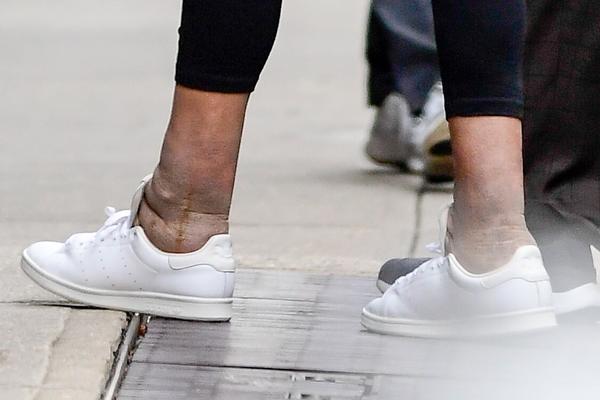 SLAVNA VODITELJKA JE SVE RASTUŽILA NATEČENIM NOGAMA: Ceo svet je veoma zabrinut! (FOTO)