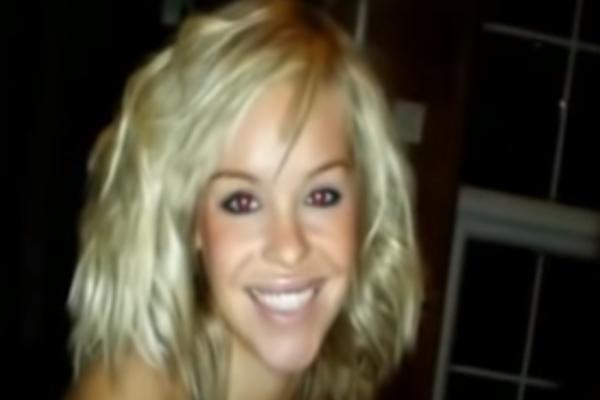 DEČKO JOJ PROSUO SUMPORNU KISELINU U LICE, NASTRADALO OKO! Voditeljka prolazi kroz pakao,evo kako izgleda (FOTO)