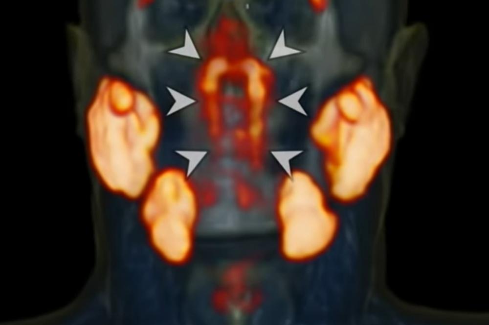 VELIKI ŠOK ZA NAUČNIKE! Ovo svi imamo u GLAVI, a utiče na ceo organizam! Ni mikroskop ne pomaže! (VIDEO)