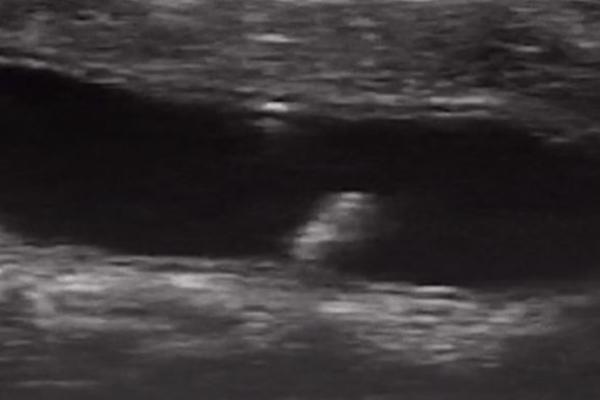 OVO JE SNIMAK REVOLUCIJE U MEDICINI! Naučnici ubacili NANOROBOTA u debelo crevo, budućnost je upravo POČELA (VIDEO)