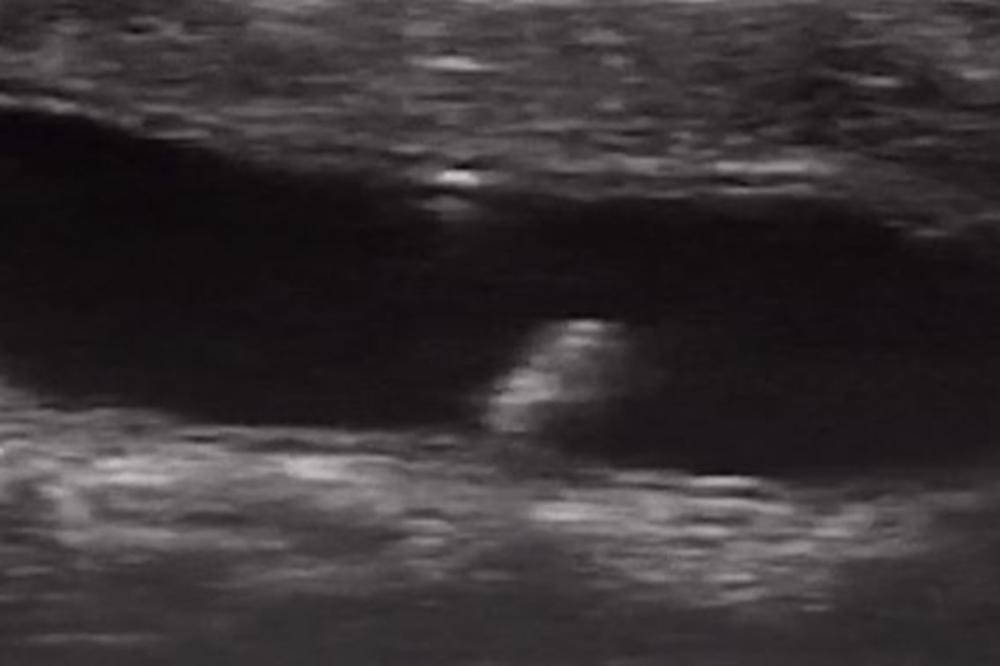 OVO JE SNIMAK REVOLUCIJE U MEDICINI! Naučnici ubacili NANOROBOTA u debelo crevo, budućnost je upravo POČELA (VIDEO)