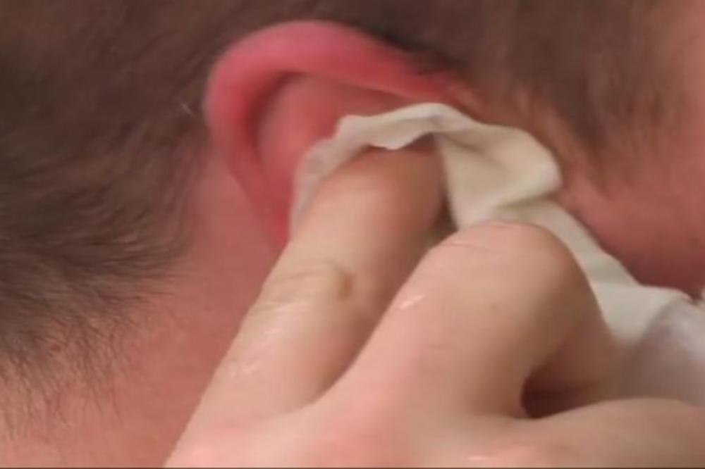 BOLELO GA UHO, A ONDA SU MU LEKARI IZVADILI GNUSOBU IZ NJEGA: Ovo mu se NAKOTILO u glavi, NAJGNUSNIJA STVAR IKAD!