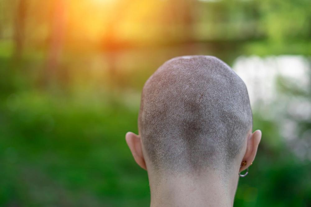 KAZNA ZA PRIMITIVCE! Roditelji, stric i tetka koji su OBRIJALI GLAVU DEVOJKE jer se viđala sa SRBINOM su OSUĐENI