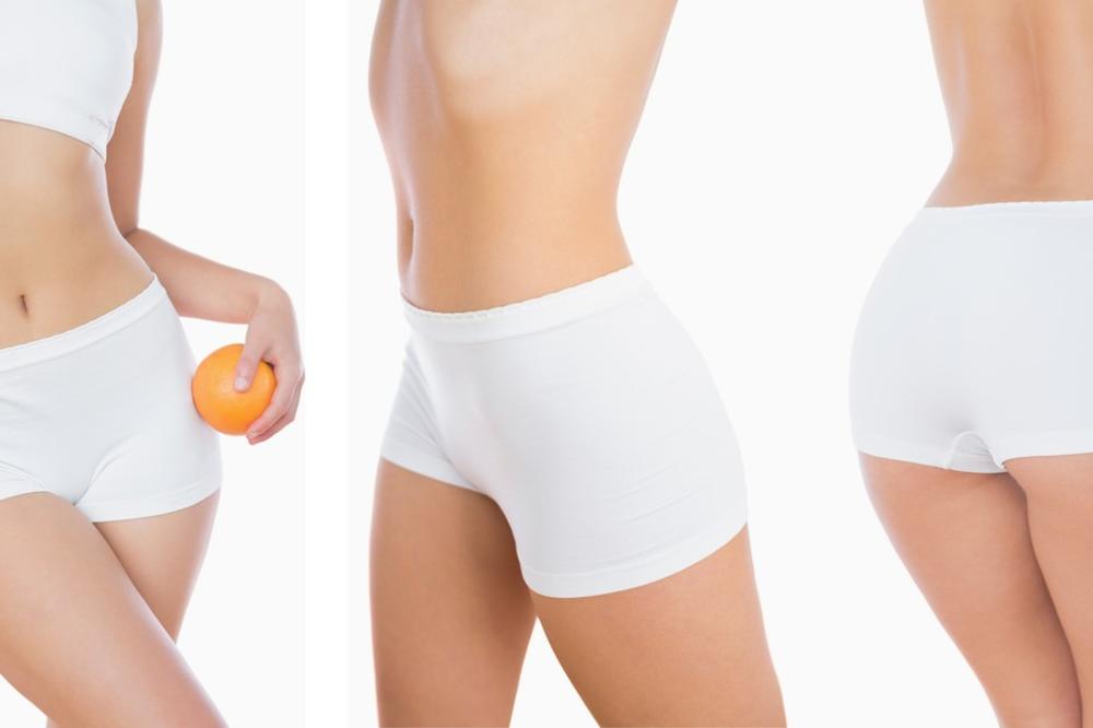 EVO KAKO DA SMRŠATE U REKORDNOM ROKU BEZ GLADOVANJA: Stručnjaci su otkrili JEDAN JEDINI PRAVI NAČIN