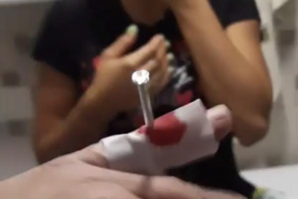 IVANU MARINKOVIĆU EKSER PROBUŠIO CEO PRST! Krv lila kao REKA, sve je SNIMLJENO! (VIDEO)