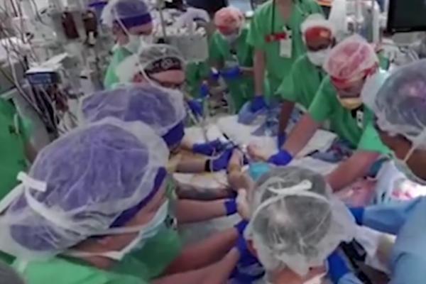 HIRURZI SU RASTAVILI SIJAMSKE BLIZNAKINJE: Operacija trajala 24 sata, reči majke DIRNULE SU SVE