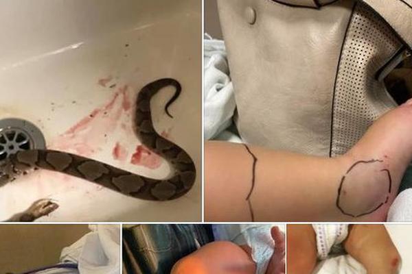 ZMIJA SE SAKRILA MEĐU IGRAČKAMA DEVOJČICE (1): Onda je nastao HOROR, dete su brzo prebacili u bolnicu! (FOTO)