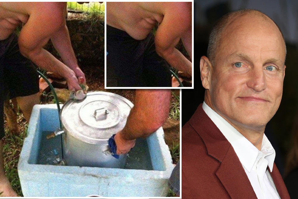 NA STOMAKU SRBINA UKAZALO SE LICE ČUVENOG HOLIVUDSKOG GLUMCA: Ovo je čudo neviđeno!!! (FOTO)