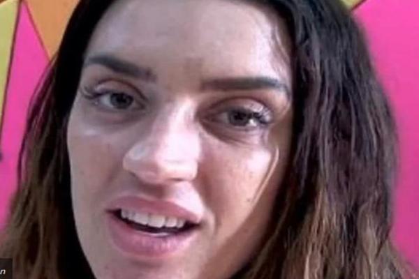 Imala preko 20 PLASTIČNIH OPERACIJA i sada je ni rođena majka NE PREPOZNAJE! EVO kako je IZGLEDALA PRE