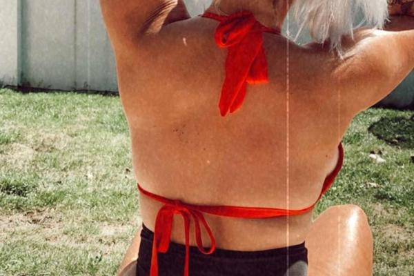 JEZIVE RANE ZBOG VELIKIH GRUDI, POTPUNO ISKASAPLJENA: Lepa plavuša MOLI ZA POMOĆ, mora na HITNU OPERACIJU! (FOTO)