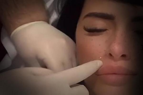 MALOLETNA JE POČELA DA POSEĆUJE PLASTIČARA, A SA 16 GODINA JE RODILA! Nju svi vole, a niko NE ZNA pravu ISTINU!