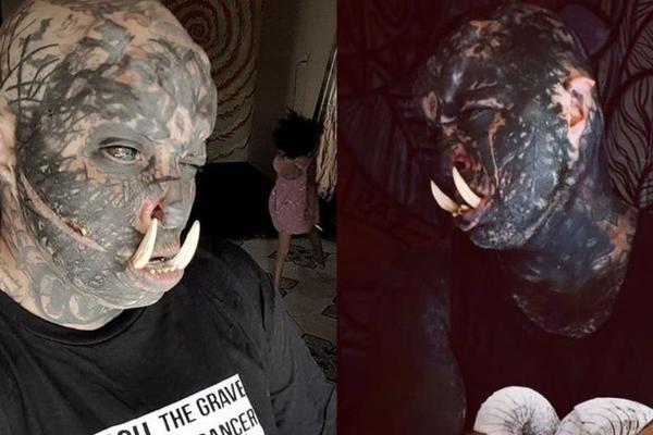 ISTETOVIRAO 80 ODSTO TELA, A SAD JE INSTALIRAO I KLJOVE!!! Čoveče, čoveče... ŠTA SI TO URADIO OD SEBE? (FOTO)