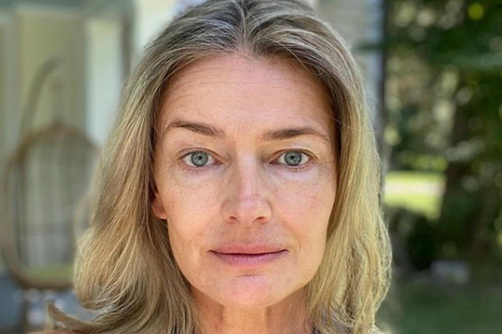 CEO SVET PLAČE ZBOG SUDBINE SLAVNE MANEKENKE: Zbog MUŽA završila u INVALIDSKIM KOLICIMA!