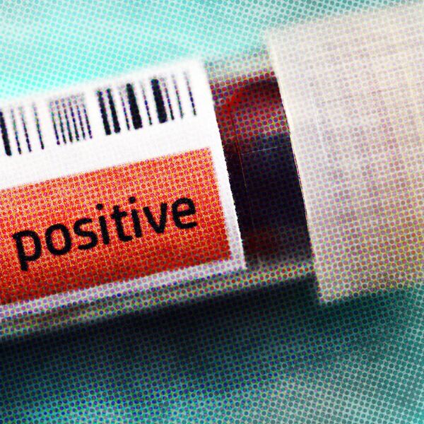 JAKO LOŠE BROJKE: Novih 400 zaraženih i 11 smrtnih slučajeva u Severnoj Makedoniji