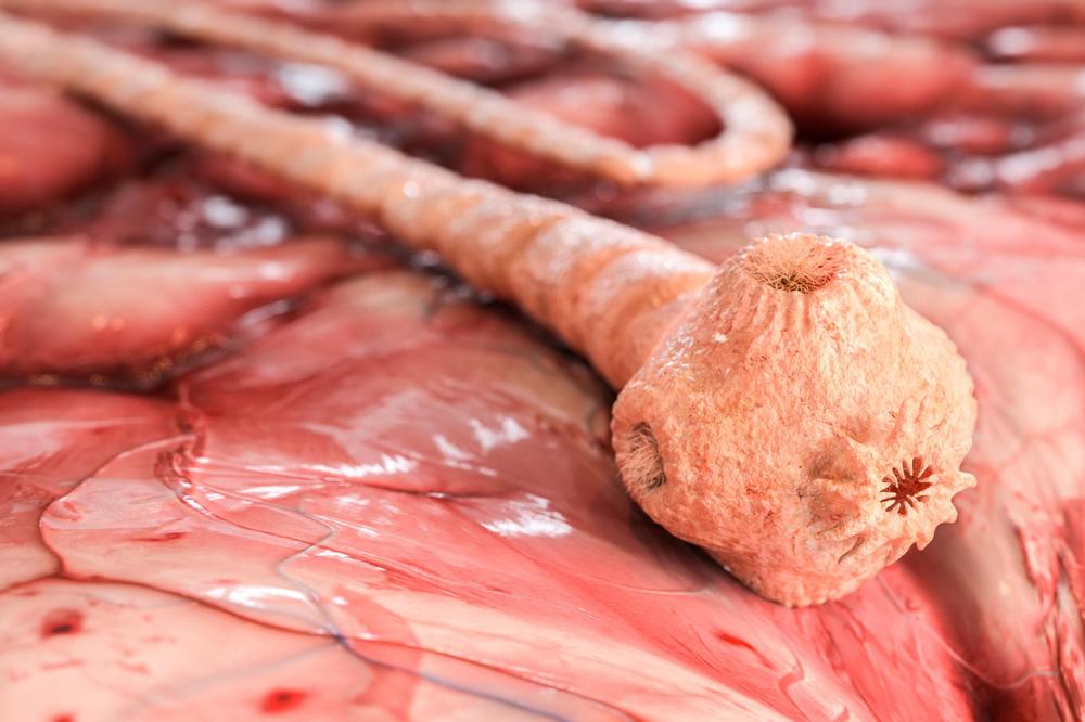 SPUSTIO SE U KANALIZACIJU I OSETIO DA MU NEŠTO GMIŽE ISPOD KOŽE: Lekari se zaprepastili kada su shvatili šta je