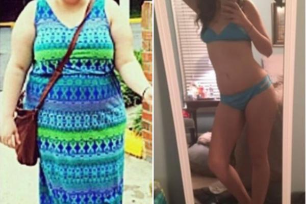 OVAKVU PROMENU NIKAD NISTE VIDELI! Preko noći smršala 45 kilograma, završila školovanje i postala MODEL!