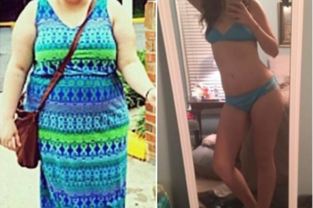 OVAKVU PROMENU NIKAD NISTE VIDELI! Preko noći smršala 45 kilograma, završila školovanje i postala MODEL!