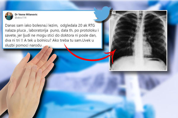 IAKO SAM BOLESNA, DANAS SAM ODGLEDALA 20 RTG NALAZA PLUĆA: Dr Vesna Milanović daje PRIVATNO SAVETE, I TO ZA DŽABE!