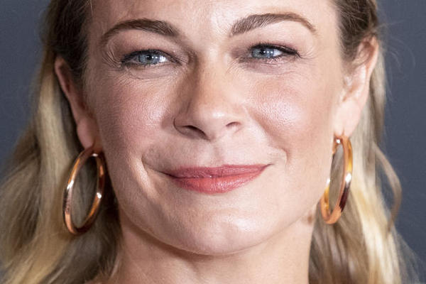 PEVAČICI BOLEST UNIŠTILA ŽIVOT: Sva je u flekama i krastama, a za sve krivi STRES! Ovo je JEZIVO! (FOTO)