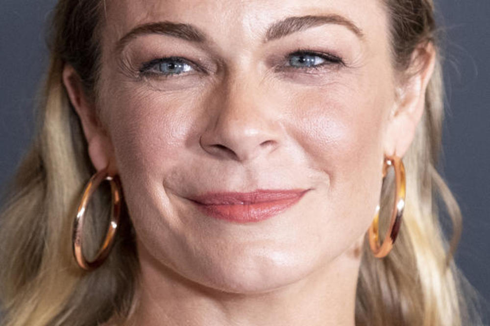 PEVAČICI BOLEST UNIŠTILA ŽIVOT: Sva je u flekama i krastama, a za sve krivi STRES! Ovo je JEZIVO! (FOTO)