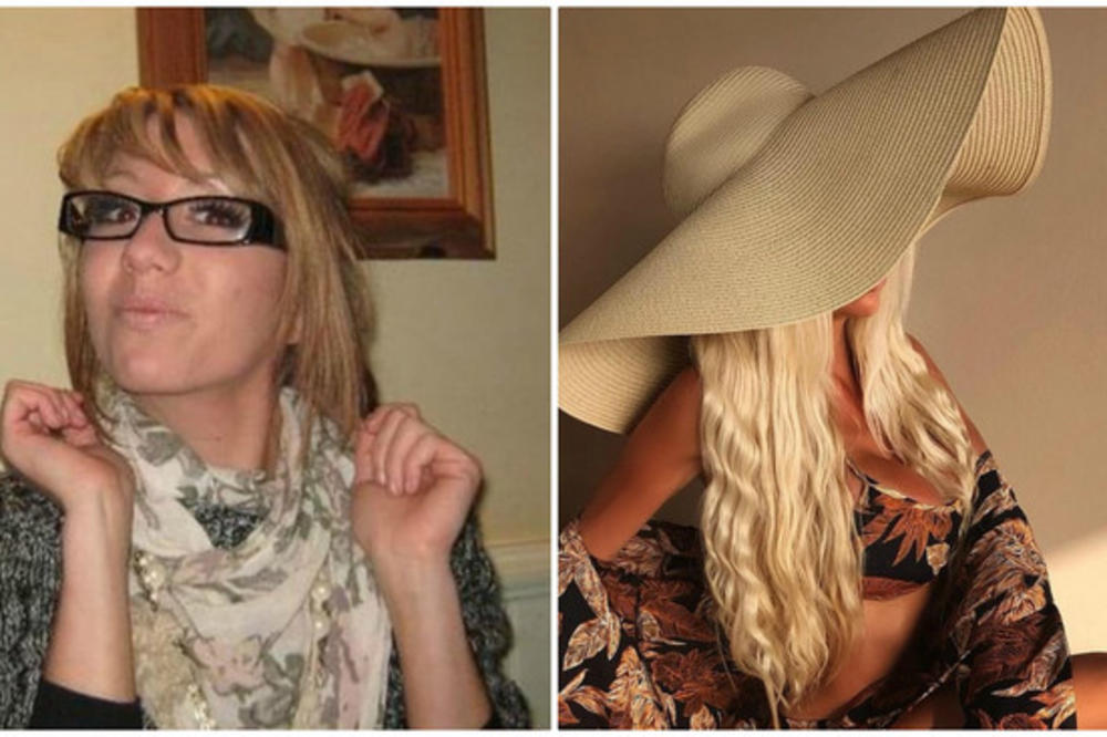 PRE PLASTIČNIH OPERACIJA LJUDI SU JOJ SE SMEJALI ALI KAD JE ZAVRŠILA: Ova transformacija je NEREALNA! (FOTO)