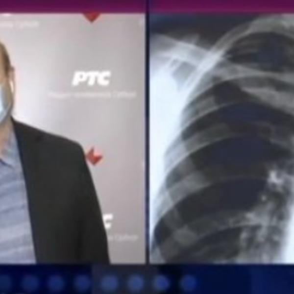 DOKTOR IVKOVIĆ UPOZORIO SVE GRAĐANE SRBIJE NA OVIH PET ZNAKOVA! Ljudi, ovo je OZBILJNO!