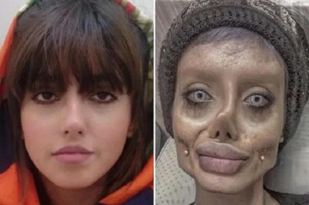 IZOPERISALA SE DA POSTANE ANĐELINA DŽOLI A SADA JE DOŽIVELA KATALKIZMU: Da li je realno da joj se ovo desilo?