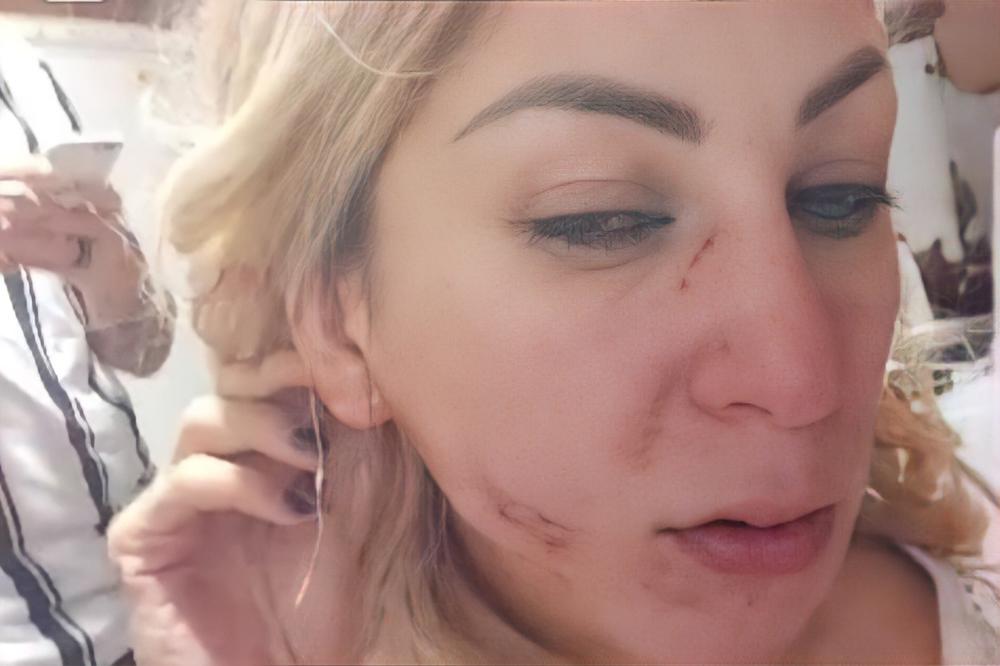 REŠILA DA TOMU SRAVNI SA ZEMLJOM: Neviđeni snimak Nadeždinog batinjanja, LICE NADUTO I CRVENO OD ŠAMARA! (VIDEO)