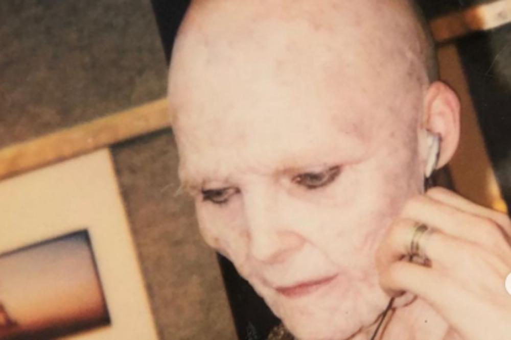 JEZIVO IZGLEDA, PROPALA JE, ĆELAVA I STARA: Holivudska lepa glumica više NE LIČI NA SEBE, ZNATE LI KO JE NA FOTKI?!