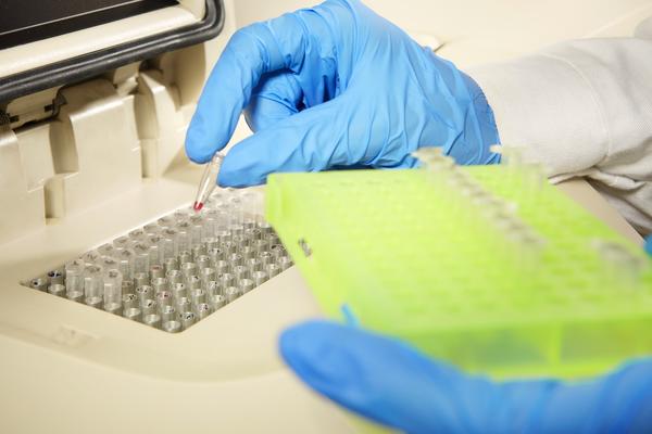 VELIKA POMOĆ SATLERA: Republici Srpskoj uručio više od 22 hiljade PCR testova!