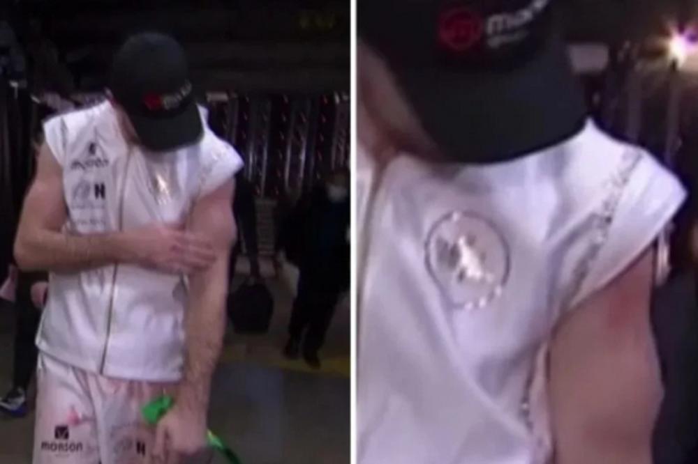 UNAKAZIO MU JE RUKE! Kanelo ga je toliko jako isprebijao, ruka mu je promenila izgled!