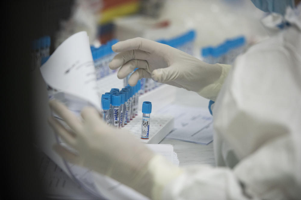 NASTAVLJA SE PAD BROJA OBOLELIH U SRBIJI: U poslednja 24 sata preminula 43 pacijenta!