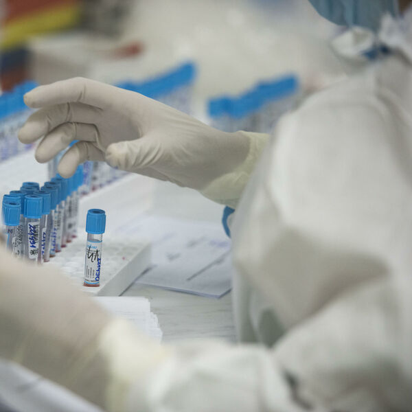 KORONA MOŽE DA PREĐE NA MOZAK, SRCE I SKORO SVAKI ORGANSKI SISTEM U TELU! Rezultati najnovije studije