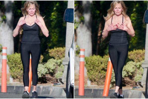 NEKADA JE BILA ANĐEO LEPOTE I CEO SVET JE LUDEO ZA NJOM! Sada se UNAKAZILA plastičnim operacijama i svi su ŠOKIRANI