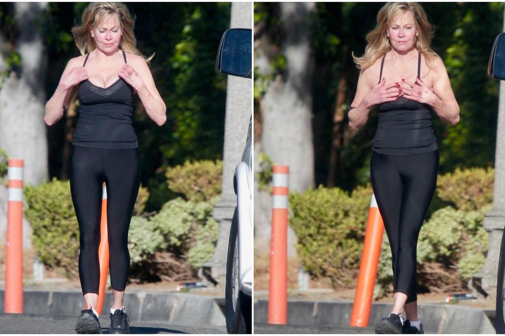 NEKADA JE BILA ANĐEO LEPOTE I CEO SVET JE LUDEO ZA NJOM! Sada se UNAKAZILA plastičnim operacijama i svi su ŠOKIRANI