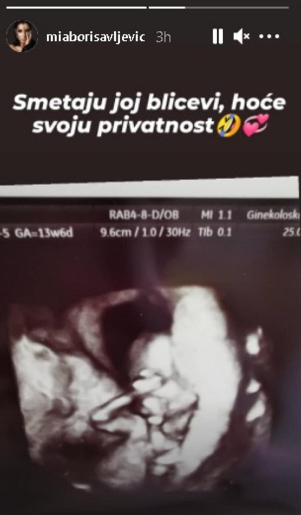 zabava, estrada, Mia Borisavljevic