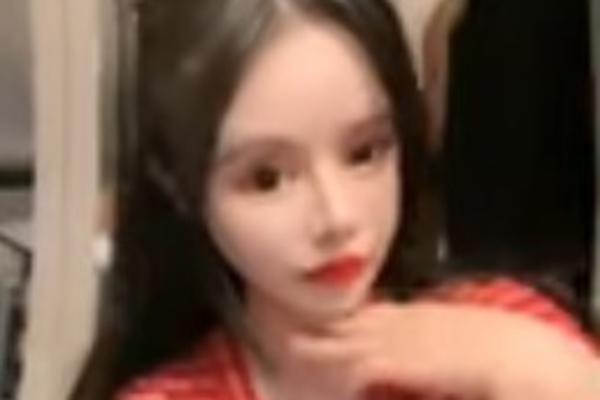 UPOZNAJTE NAJMLAĐU ZAVISNICU ESTETSKE HIRURGIJE Prvu operaciju je imala sa samo 13 godina i nema nameru da stane