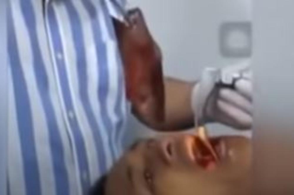 GUŠIO SE, POKAZIVAO LEKARIMA NA GRLO, NISU ZNALI ŠTA SE DEŠAVA: Horor, u jednjaku mu bila ŽIVOTINJA (VIDEO)