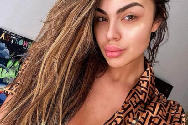 PRETERALA SA OPERACIJAMA, PA ZABRANILA OSUDE I KOMENTARE?! Važila je za NAJLEPŠU ZADRUGARKU!