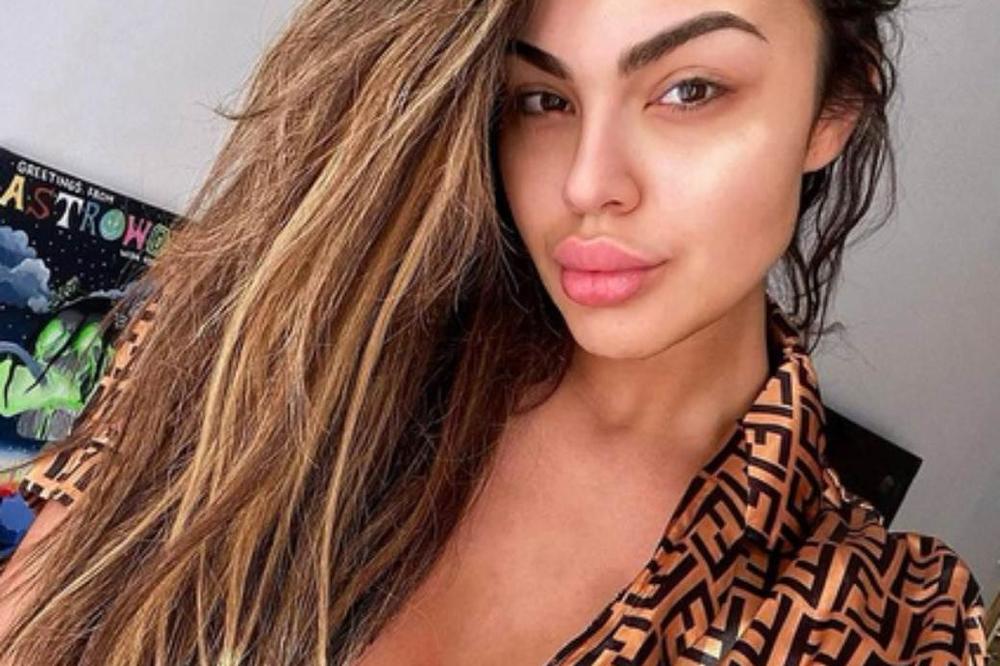 PRETERALA SA OPERACIJAMA, PA ZABRANILA OSUDE I KOMENTARE?! Važila je za NAJLEPŠU ZADRUGARKU!