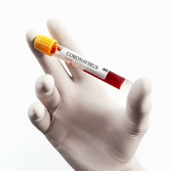 PREMINULO 36 OSOBA OD KORONE U SEVERNOJ MAKEDONIJI: Oglasilo se Ministarstvo, stanje je alarmantno!