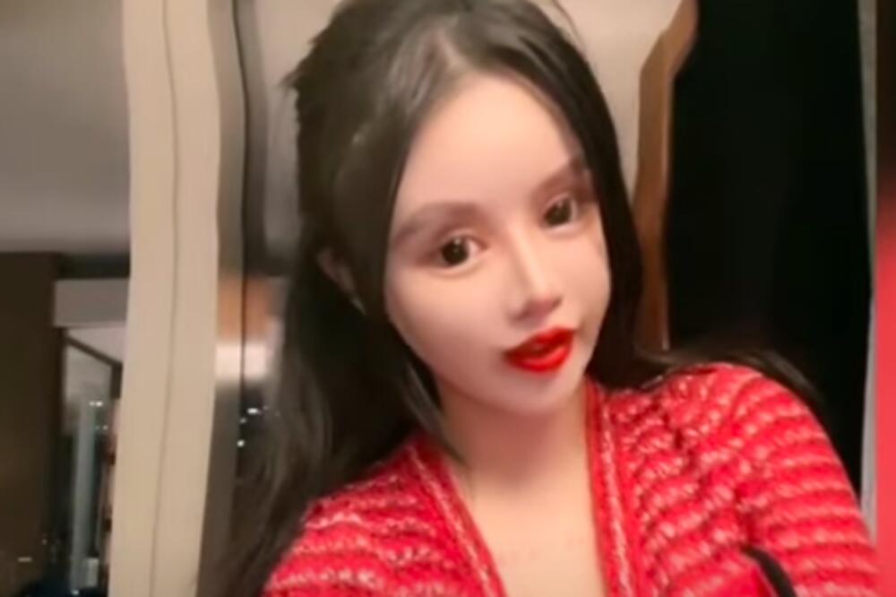 IMA SAMO 16 GODINA, a već se 100 puta OPERISALA - pogledajte našta liči DEVOJČICA koja se PLAŠI RUŽNOĆE (VIDEO)