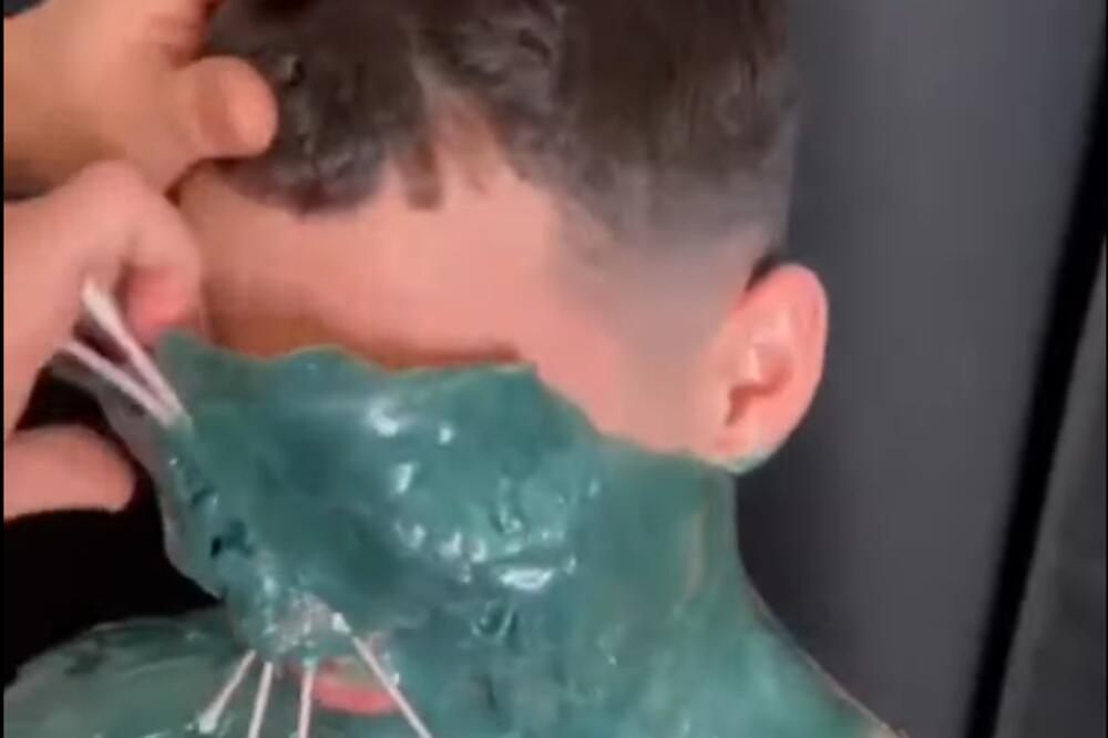 DEPILACIJA CELOG LICA JE POSTALA HIT NA TIK TOKU! Svi dolaze u poznatu berbernicu, a odlaze bez i jedne dlake!