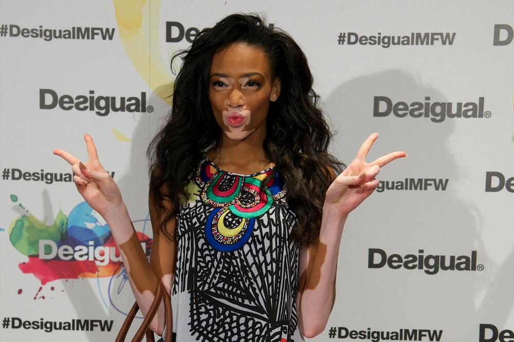 NAZIVALI SU JE POGRDNIM IMENIMA, HTELA JE DA IZVRŠI SAMOUBISTVO: Atraktivna manekenka DANAS ŽIVI ŽIVOT KAO IZ BAJKE