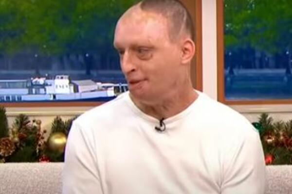 ISPOVEST MOMKA KOGA JE BIVŠA DEVOJKA POLILA KISELINOM LEDI KRV U ŽILAMA! Danijel je sve ispričao do detalja (VIDEO)