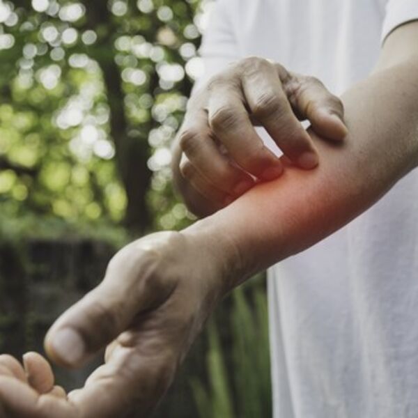 ŠUGA HARA CRNOM GOROM: U ovim gradovima ima najviše OBOLELIH