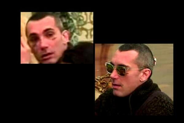 UČESNIK PAROVA UNAKAŽEN U TUČI: Celo lice mu u podlivima i izgleda kao LEŠ, produkcija štiti nasilnika-NIJE IZBAČEN