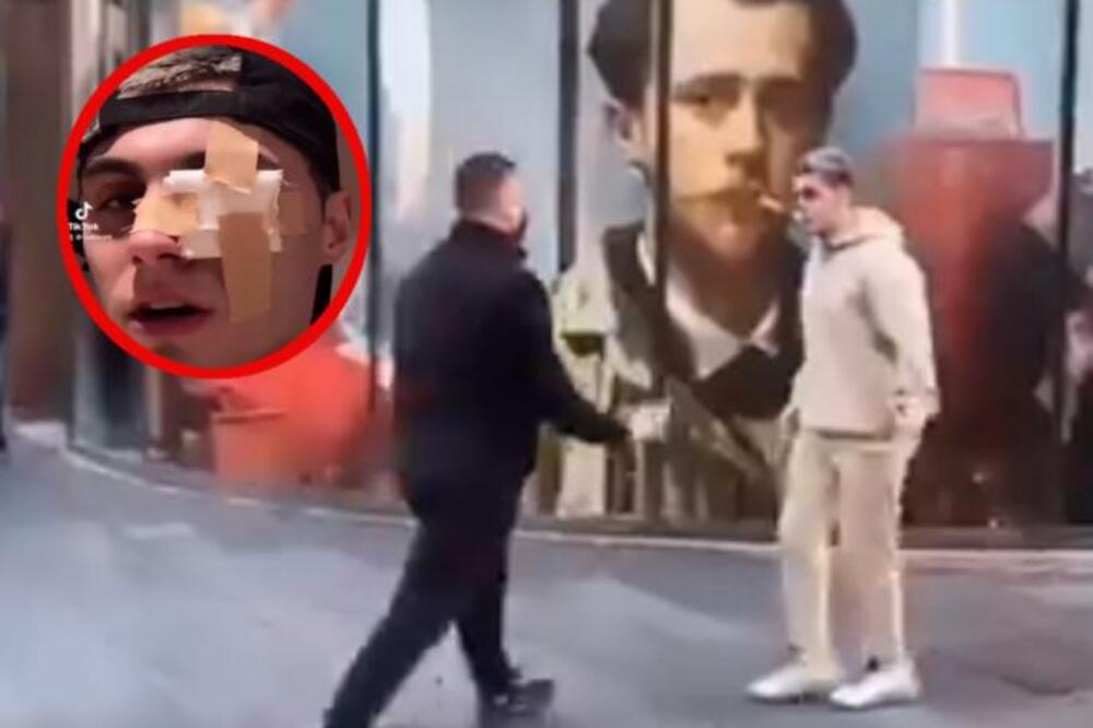 TIK TOKER ZBOG SVOJE BAHATOSTI BRUTALNO PRETUČEN U KNEZ MIHAJLOVOJ: Nokautirao ga, PALA KRV, oko mu UNIŠTENO!