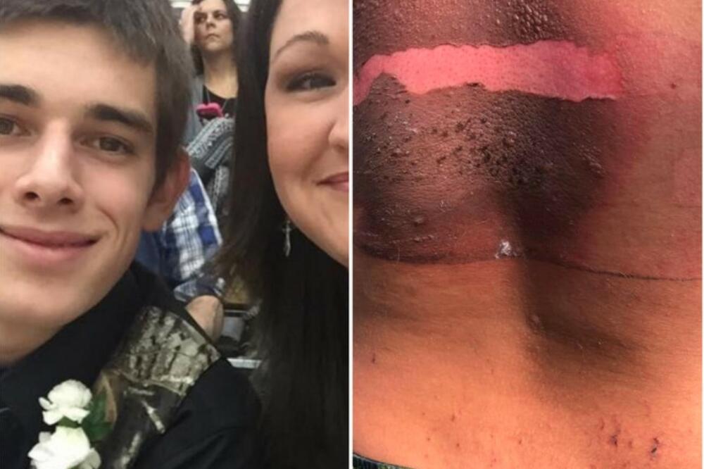 PODELILA ZABRINJAVAJUĆE SLIKE SVOG SINA: Upozorava roditelje rečima „Samo je radio nešto što SVI tinejdžeri rade“