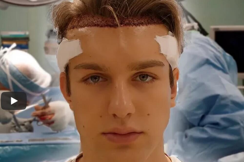 JEZIVO! KRV NA SVE STRANE! MLADI JUTJUBER OTIŠAO POD NOŽ: Snimao se iz OPERACIONE SALE!